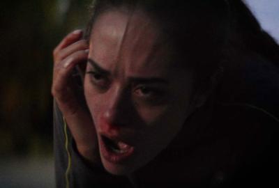  Lily has blood on her face